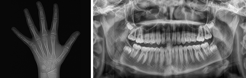 Ortodonti Bostanlı Izmir | İlk Ziyaretiniz